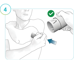 Illustrasjon av trinn 4: En person som bruker applikatoren til å sette CGM-en inn i det klargjorte påføringsstedet.