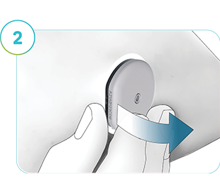 Bildet viser hvordan du fjerner SmartGuide-sensoren.