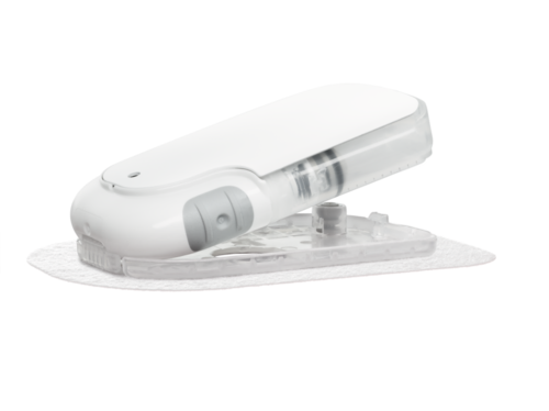 Bilde viser Accu-Chek Solo mikropumpesystem, designet for mennesker med diabetes